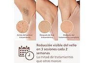 Depiladora de Luz Pulsada (IPL) Philips Lumea Serie 9000 (BRI958/00)