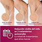 Depiladora de Luz Pulsada (IPL) Philips Lumea Serie 7000 (BRI920/00) - Electrodomésticos Idea SL