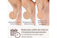 Depiladora de Luz Pulsada (IPL) Philips Lumea Serie 8000 (BRI945/00)